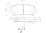 Brembo OE Prem NAO Ceramic Pads (Rear) - 07-13 Acura MDX/10-13 ZDX/11-17 Honda Odyssey by Brembo P28082N-BRE
