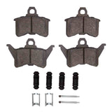 R1 Concepts 88-90 Chrysler New Yorker Rear Semi Met Pads & Hardware Kit by R1 Concepts RNC-2311-0386-01