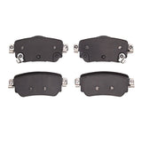 R1 Concepts 17-25 Nissan Leaf Rear R1 Concepts Optimum OE Brake Pads by R1 Concepts RNC-2551-1965-00