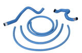 Blue Xtreme Hose Kit | 5004