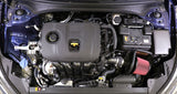 AEM AEM C.A.S. 19-20 Kia Forte 2.0L F/I 21-858C